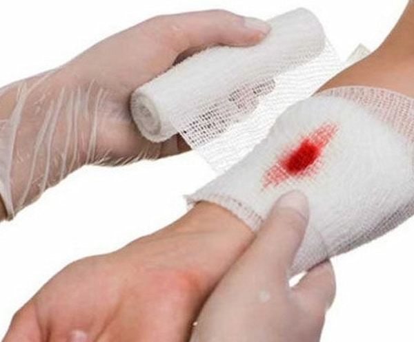 تصویر 5 از قیمت خرید گاز استریل پهن با فروش عمده
